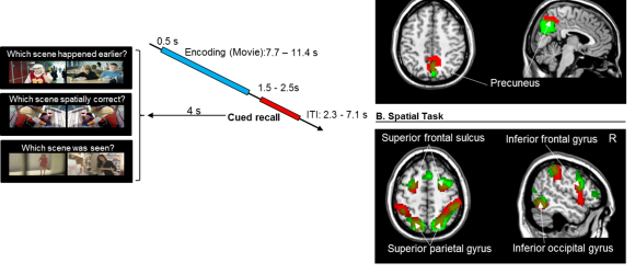 Sze Chai Kwok's Paper Published Online in Human Brain Mapping
